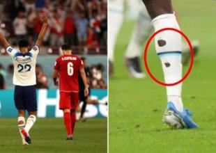 Why Do Some Footballers Cut Holes In Their Socks? Here’s The Answer