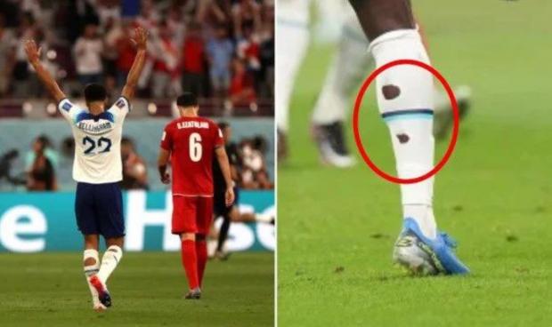 Do You Know Why Footballers Cut Holes In Their Socks?