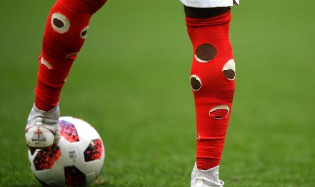 Which footballers have cut holes in their socks?
